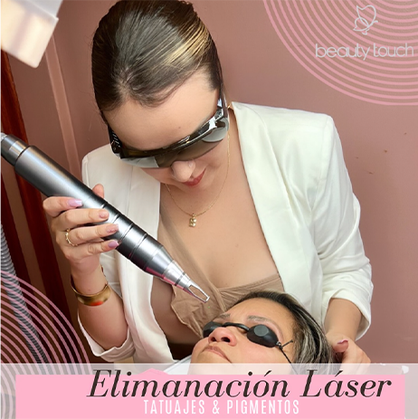 remoción de tatuajes en valle de los chillos